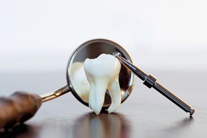 how missing teeth affect your health