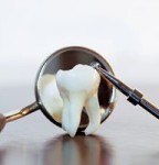 مواد غذایی که احتمال پوسیدگی دندان را افزایش می دهند